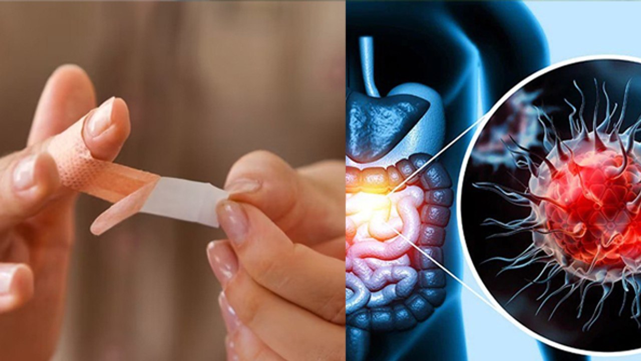 बैंडेज लगाने से क्या कैंसर होता है Bandage Lagane Se Cancer Hota Hai