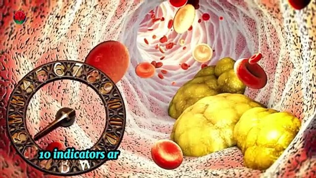 10 WARNING SIGNS OF HIGH CHOLESTEROL YOU SHOULDN'T IGNORE.