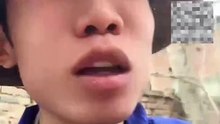 男孩幫父親養蜜蜂，嘴都被扎腫了。Boy had a swollen lip from raising bees.
