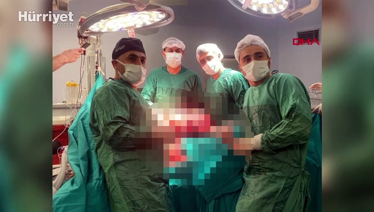 Böbrek ağrısıyla gitti, karnından 8 kiloluk tümör çıkarıldı