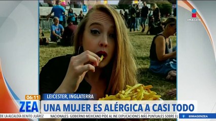 Mujer es alérgica a casi todo