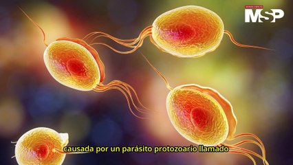 Tricomoniasis: conoce la ITS curable más común en el mundo - #EspecialMSP