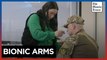 Decorated 'Hero of Ukraine' learns to live with bionic arms