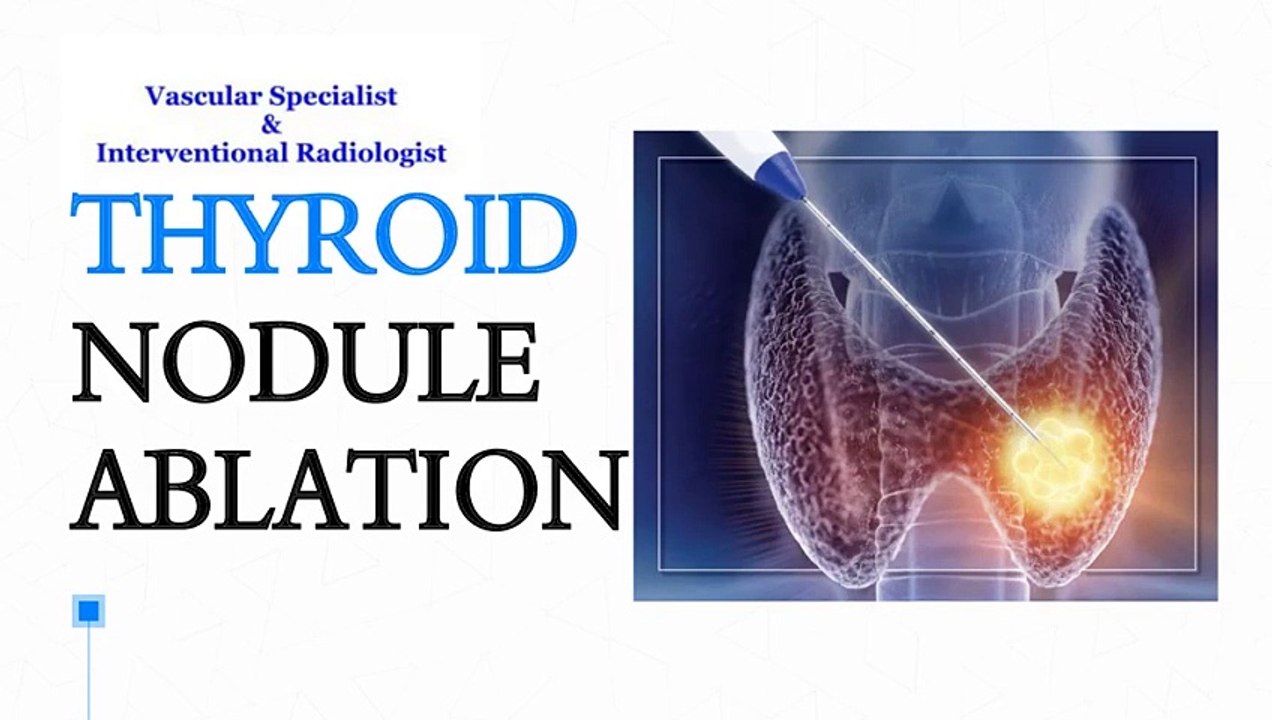Thyroid Nodule Ablation