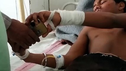 चार्जिग के दौरान मोबाइल में हुए शोर्ट-सर्किट से युवक का हाथ झुलसा