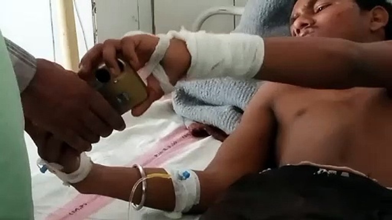 चार्जिग के दौरान मोबाइल में हुए शोर्ट-सर्किट से युवक का हाथ झुलसा