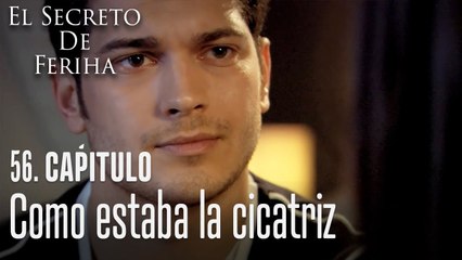Como estaba la cicatriz - El Secreto De Feriha Capítulo 56 En Español