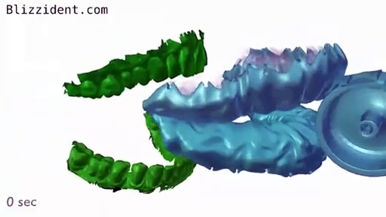 Un cepillo de dientes impreso en 3D que limpia de manera profunda en solo 6 segundos