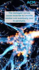 What is motor neurone disease?