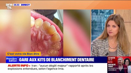 Pourquoi faut-il se méfier des kits de blanchiment dentaire?