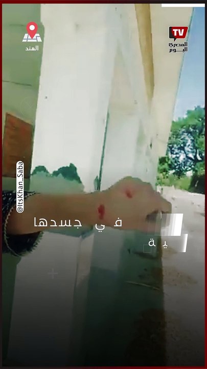 الهند| مديرة مدرسة «تعض» معلمة بعدما وثقت مخالفاتها