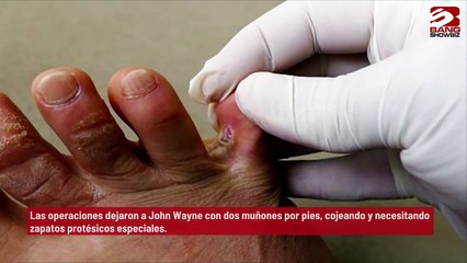 John Wayne Bobbitt pierde los dedos de los pies