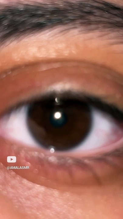 Eye
