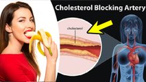 केला खाने से कोलेस्ट्रॉल बढ़ता है या नहीं | Kela Khane Se Cholestrol Badhta Hai Ya Nahi | Boldsky