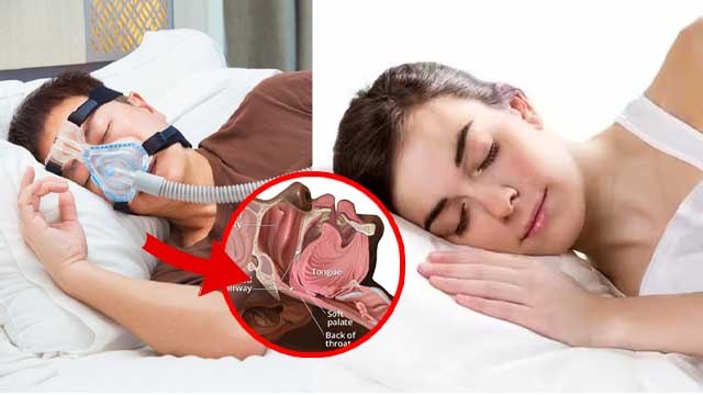 Sleep Apnea Se Kese Bache |What Causes Sleep Apnea And How To Get Rid Of It|Boldsky