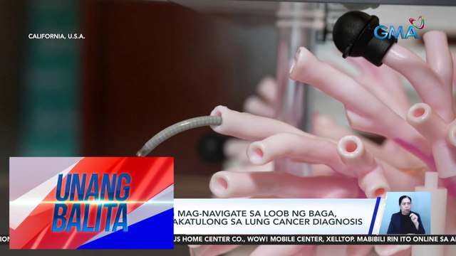 Robot na kayang mag-navigate sa loob ng baga, inaasahang makakatulong sa lung cancer diagnosis | UB