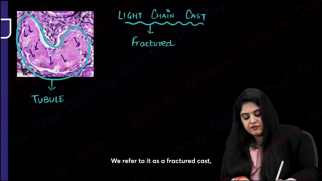 Amyloidosis immunity // general pathology