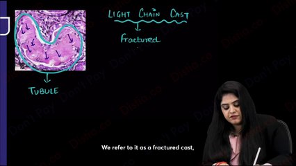 Amyloidosis immunity // general pathology