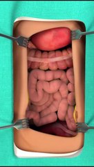 Here Is How I Recovered From Bus Accident!