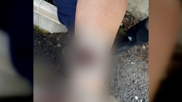 목줄 풀린 풍산개에 노인 3명 물려...병원 이송 / YTN