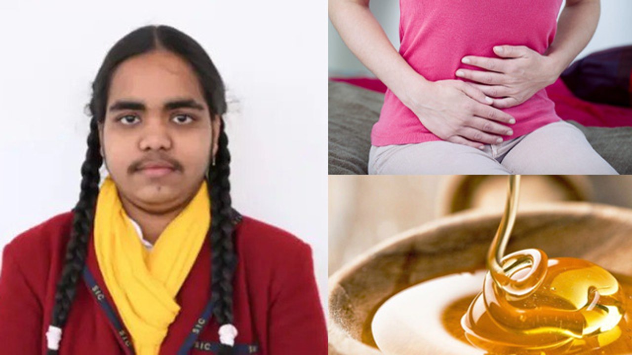 UP board 10th Class Topper Prachi Nigan PCOS Me Facial Hair Reason & Removal Tips | Boldsky