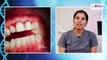 Dr Padmaja Dhanireddy About Oral Hygiene _ Dental Health _ Arcus Dental Clinic _ KPHB, Kukatpally (2)