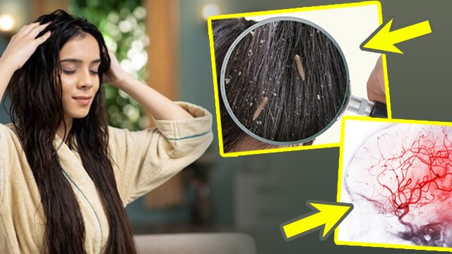 Thanda Tel Lagane Se Kya Hota Hai | ठंडा तेल लगाने से क्या होता है | Boldsky