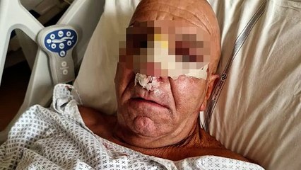 Tabaccaio massacrato per un Rolex da tre giovani: ?Vivo nella paura, ho gli incubi. Perch? questa cattiveria??