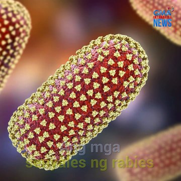 Anu-ano ang mga senyales at sintomas ng rabies? | Need to Know