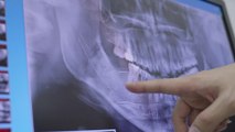 Mann will sich Zahn-Implantat setzen lassen: Plötzlich ist es in seinem Gehirn