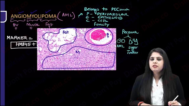 Renal tumors // renal pathology