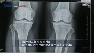[HOT] Correlation between running and knee arthritis, MBC 다큐프라임 240421