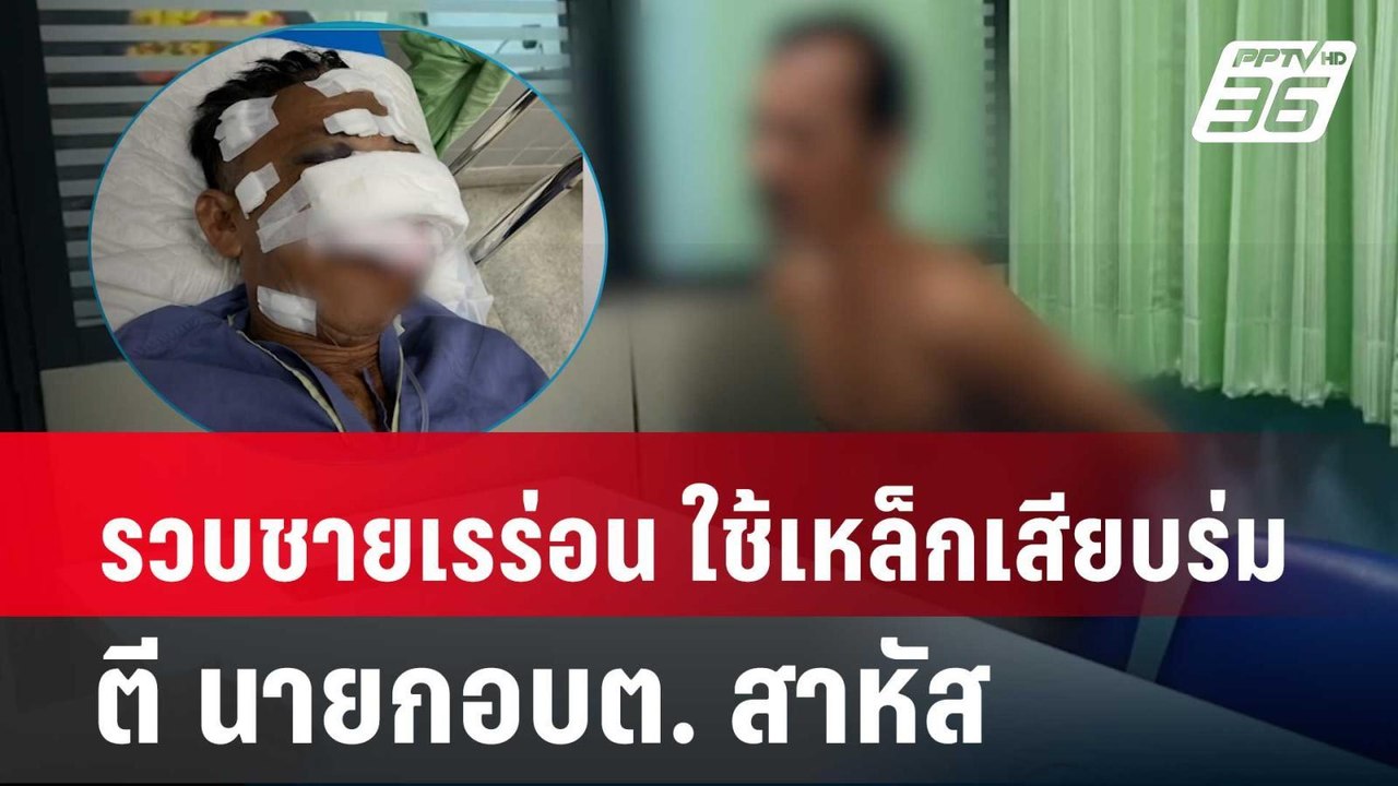 รวบชายเรร่อน ใช้เหล็กเสียบร่มตี นายก อบต. สาหัส...