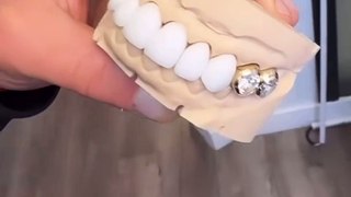 Davido affiche des dents en diamant de 100 millions FCFA (VIDEO)