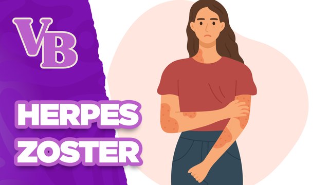 Herpes Zoster: Causas, sintomas e tratamentos - Você Bonita (29/04/2024)