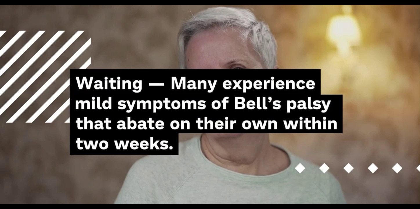 All you need to know about Bell's Palsy