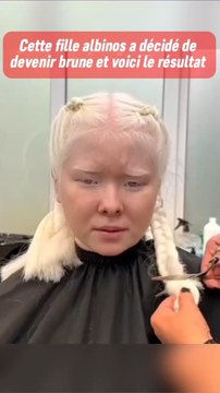 Cette fille albinos voulait du changement