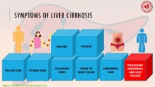 Symptoms of liver cirrhosis