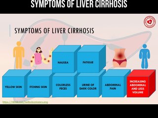 Symptoms of liver cirrhosis