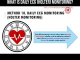 What is daily ECG (Holter) monitoring?