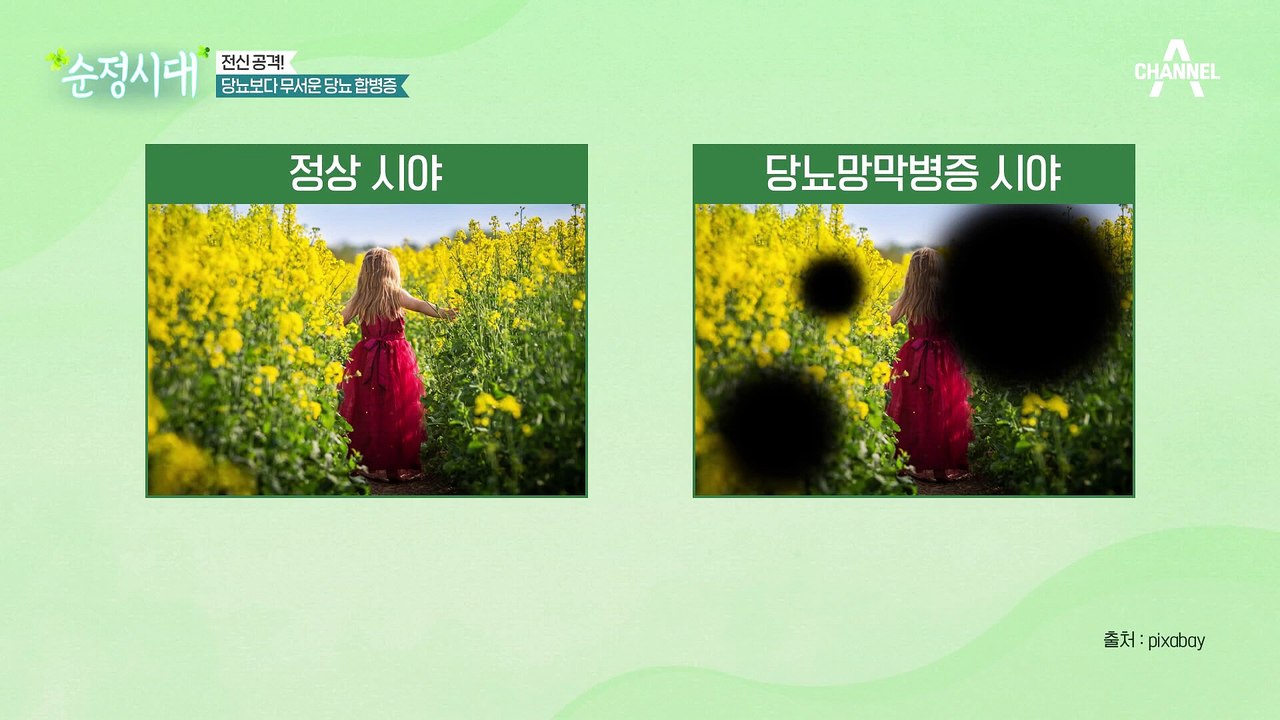 합병증 때문에 더 무섭다는 당뇨병! 심한 경우 실명까지?!