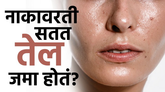 उन्हाळ्यात स्किन तेलकट होऊ नये म्हणून काय करावं? | How To Avoid Oily Skin In Summer | Skincare | MA2