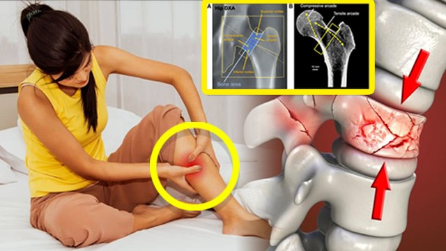 सुबह उठने पर पैर में दर्द क्यों होता है | Subah Uthne Par Pairon Me Dard Kyon Hota Hai | Boldsky