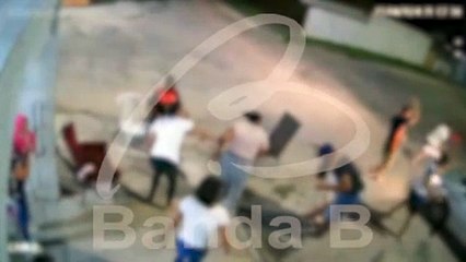 Vídeo: motorista atropela criança de 5 anos e arranca parte do couro cabeludo de mulher em Piraquara