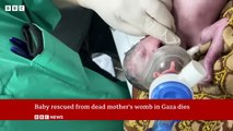 Baby saved from dead mother's womb in Gaza dies | BBC 2.0 News