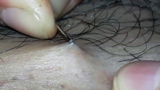 hombre con pelo encarnado que dolor!!!!!!-(1080p)