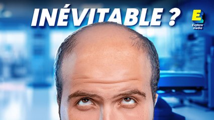Pourquoi les hommes perdent leurs cheveux ?