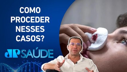 Sangramento nasal é muito comum em crianças, principalmente no calor | Dr. Salomão Carui