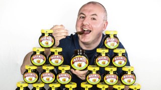 Fussy eater who was hooked on MARMITE cured by hypnosis