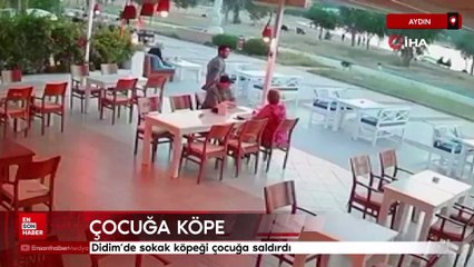 Aydın'da Didim’de sokak köpeği çocuğa saldırdı